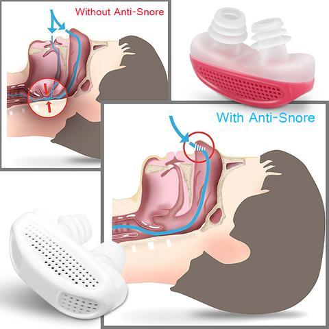 Anti Snoring Device